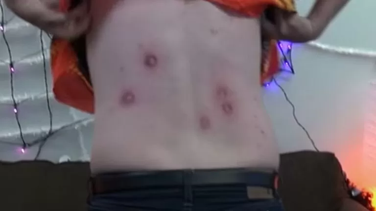 how much does paintball hurt